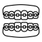 dental-braces-service