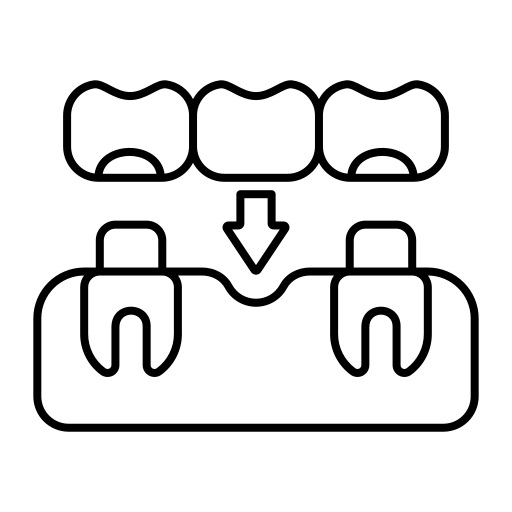 Dental-Bridges