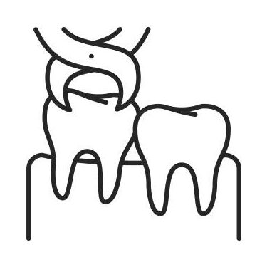 Wisdom-Tooth-Extraction