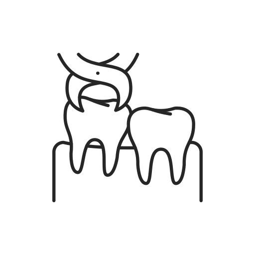 Wisdom-Tooth-Extraction